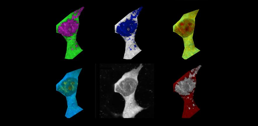 Mammalian cell stained with fluorescence polymeric thermometers and falsely-coloured based on temperature gradients.