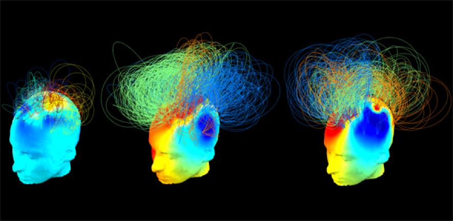 Brain signals from healthy and vegetative state patients