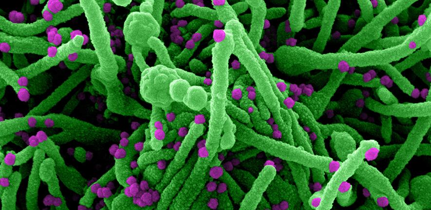 Novel Coronavirus SARS-Cov-2