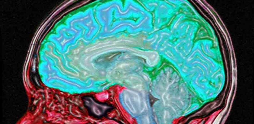 Digitally enhanced MRI of the human head showing the brain and spinal cord in blue/green and the other tissues in red and pink.