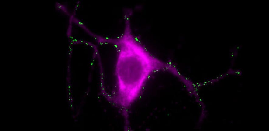 Tyrosine hydroxylase positive neuron stained with a synaptic marker