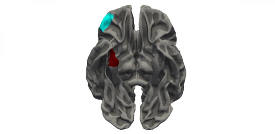 The orbitofrontal cortex (blue) and medial temporal cortex (red) were more similar in terms of thickness in youths with Conduct Disorder than in typically-developing youths, suggesting that the normal pattern of brain development is disrupted.