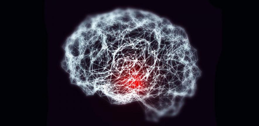 Conceptual image showing blurred brain with loss of neuronal networks