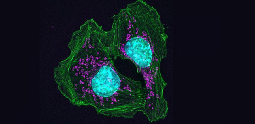 Skin cancer cells from a mouse show how cells attach at contact points