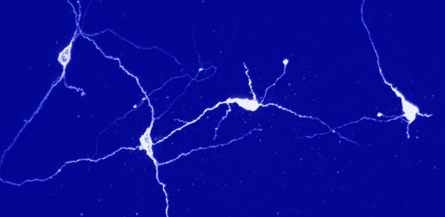 Neurons