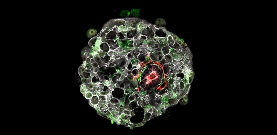 Human embryo in the lab 9 days after fertilisation.