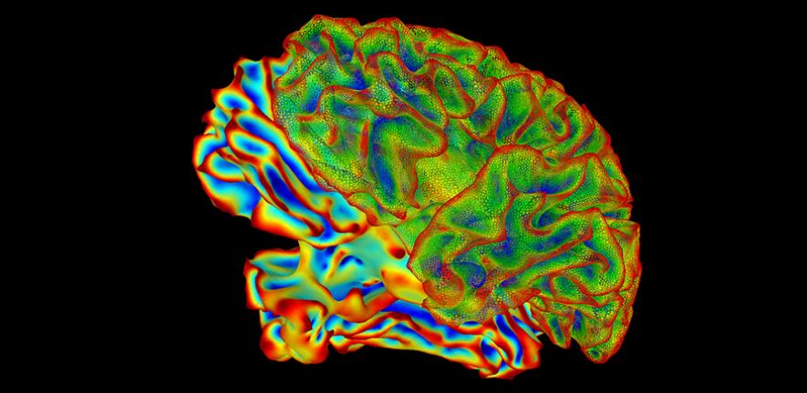 SumaLateral Whole Brain Image