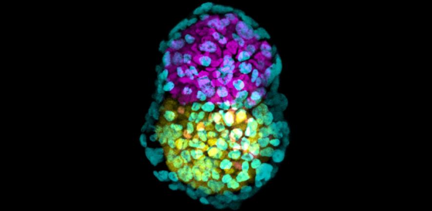 Synthetic embryo-like structure made of three stem cells types in yellow, pink and green