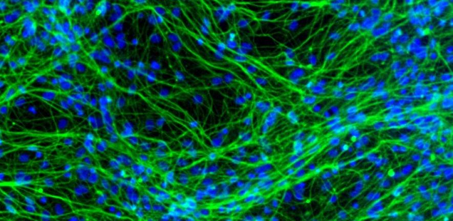 Neurons derived from human neural stem cells 