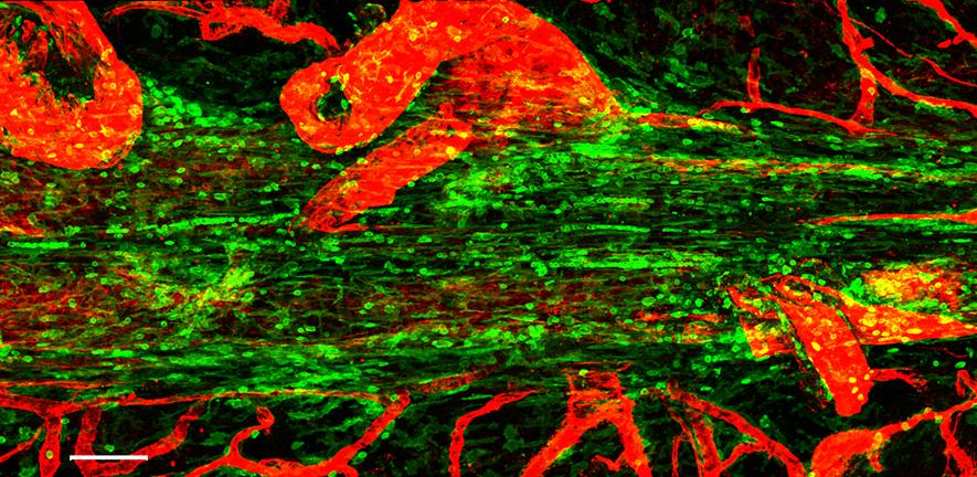 Confocal micrograph showing the superior saggital sinus in the mouse. Immune cells are shown in green lining this tube, and blood vessels in red