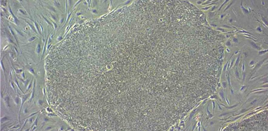 iPS cell colony