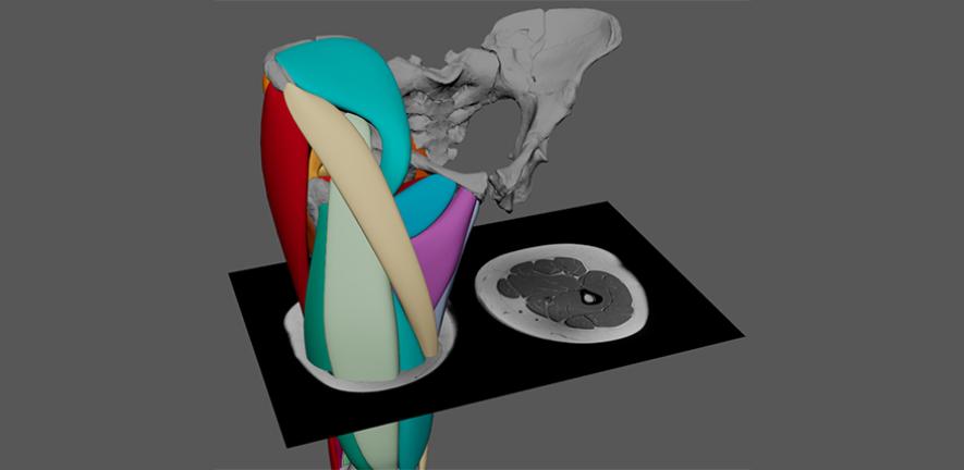A cross-section of the polygonal muscle modelling approach, guided by muscle scarring and MRI data. 