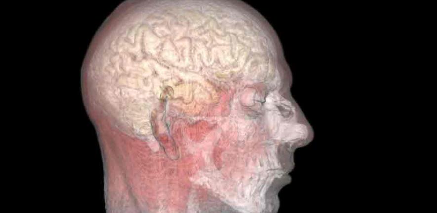 Magnetic resonance image of the mouth, ear and brain