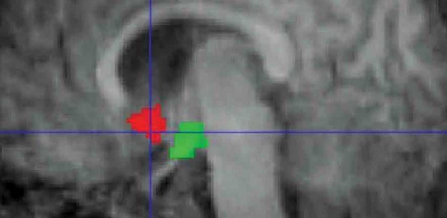 Functional MRI scan
