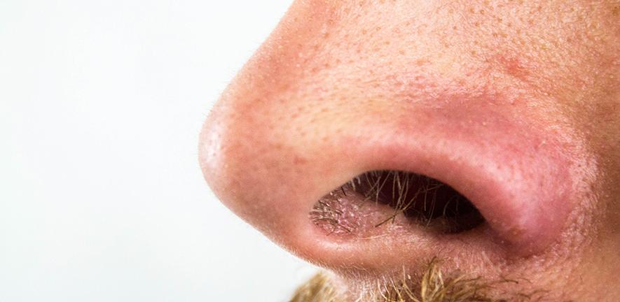 Close-up of someone's nose