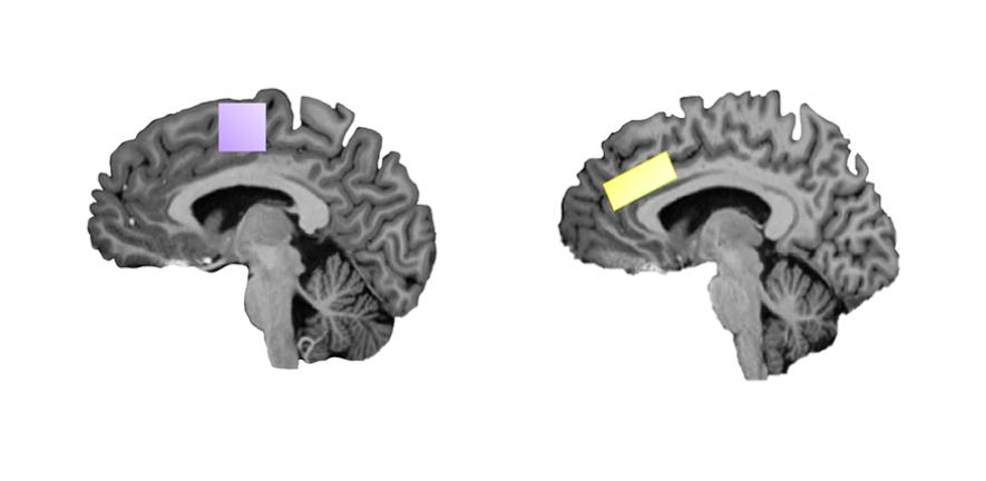 Imaging of the Supplementary Motor Area (left) and the Anterior Cingulate Cortex (right) from the study