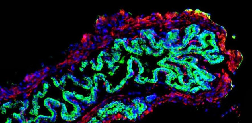 mage of a mouse gallbladder following repair with a bioengineered patch of tissue incorporating human 'bile duct' cells, shown in green. The human bile duct cells have fully repaired and replaced the damaged mouse epithelium