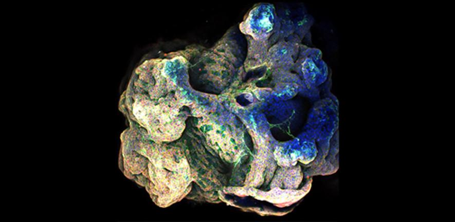 3D projection of a multi-organoid aggregate