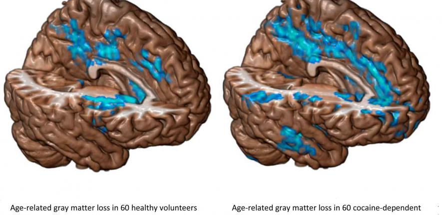 Molecular Psychiatry