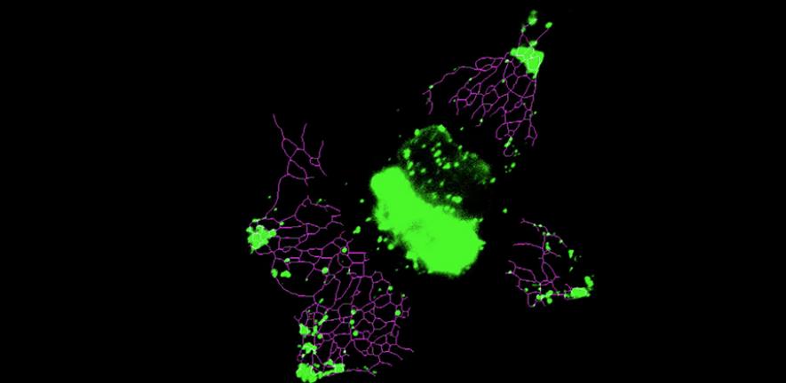 Inducing lysosome motion with light leads to a rapid and significant extension of ER network. 