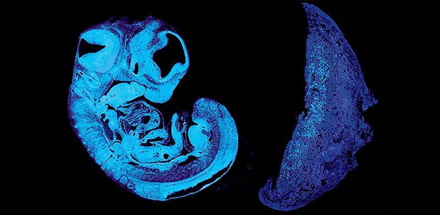 Section of mouse fetus and placenta