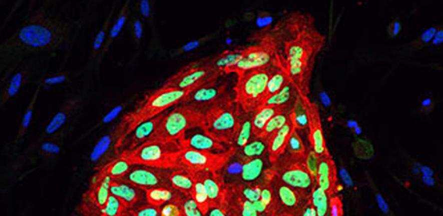 Colony of human pluripotent stem cells