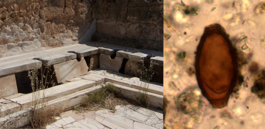 Left: Roman latrines from Lepcis Magna in Libya. Right: Roman whipworm egg from Turkey 