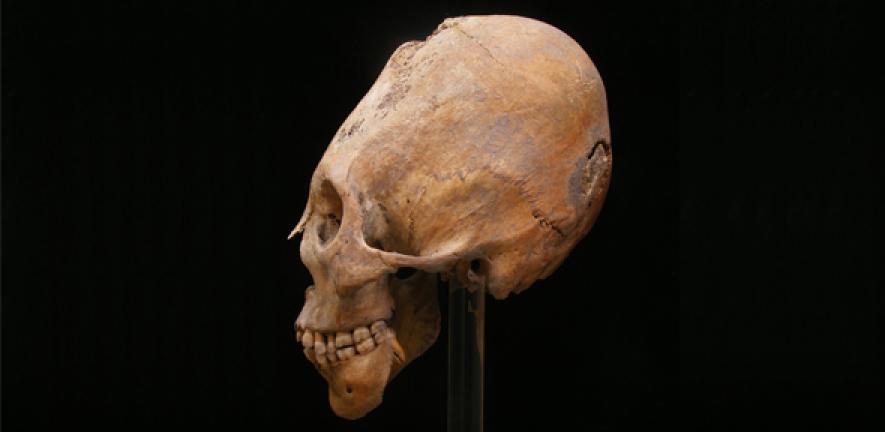 Example of a modified skull, a practice assumed to be Hunnic that may have been appropriated by local farmers within the bounds of the Western Roman Empire.