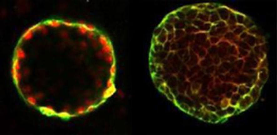 'Mini-bile ducts’ at day 25, stained with fluorescent dyes, through a microscope