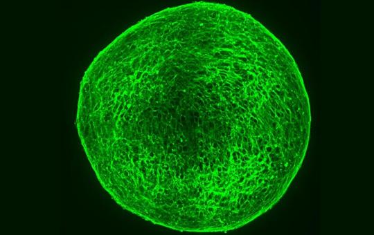 A ball of neuroblastoma cells forming mature nerves after drug treatment