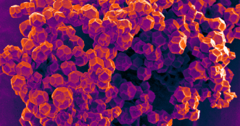 Scanning electron microscopy of highly crystalline metal-organic framework nanoparticles 
