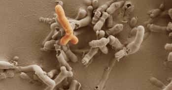 Bifidobacterium breve