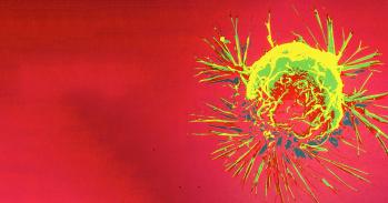 Breast Cancer Cell