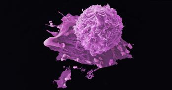 Breast cancer cells
