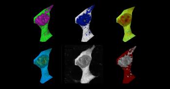 Mammalian cell stained with fluorescence polymeric thermometers and falsely-coloured based on temperature gradients.