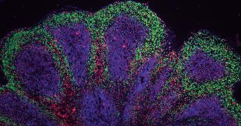 Mini brain organoids showing cortical-like structures