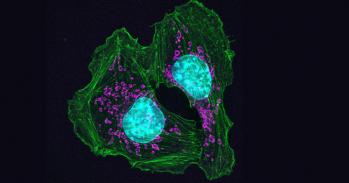 Skin cancer cells from a mouse show how cells attach at contact points