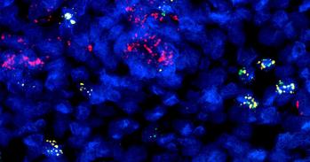 Developing immune cells (B cells) from prenatal gut tissue