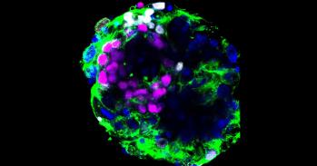 Human embryo cultured in vitro