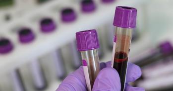 Test tubes containing blood