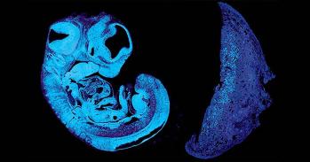 Section of mouse fetus and placenta
