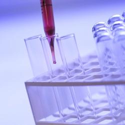 test tubes