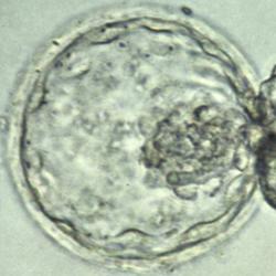 A human embryo at the blastocyst stage, about six days after fertilization, viewed under a light microscope.