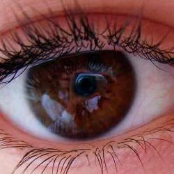 My eye