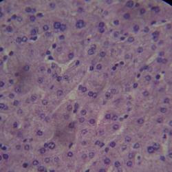 Human liver cells