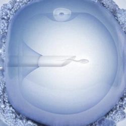 Human egg injected with sperm