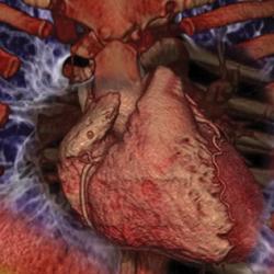 Medical Imaging