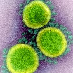 Transmission electron micrograph of SARS-CoV-2 virus particles, isolated from a patient