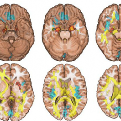Brain scans from study