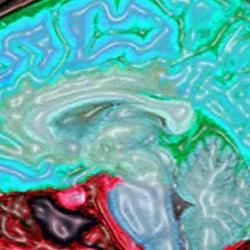 Digitally enhanced MRI of the human head showing the brain and spinal cord in blue/green and the other tissues in red and pink.